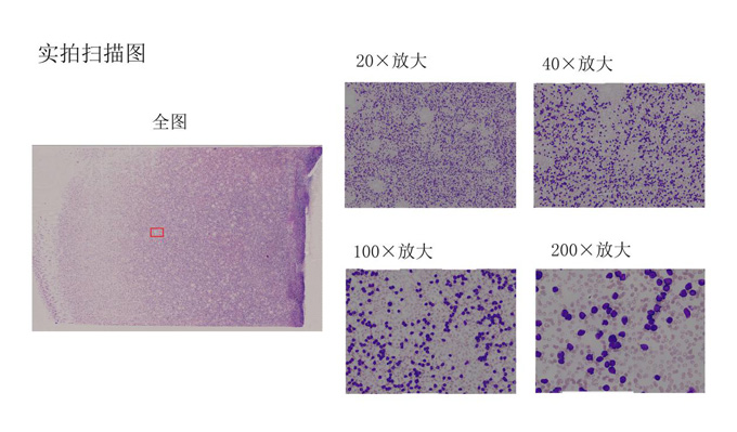 显微数字扫描系统X1-140